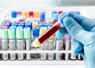 Що робити, якщо фібриноген при вагітності підвищений або знижений?