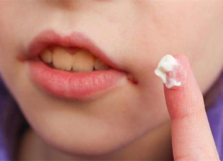 Що робити, якщо у дитини зявилися заїди?