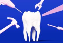 Чіпси з сиром та карієс: прихований ризик для зубів