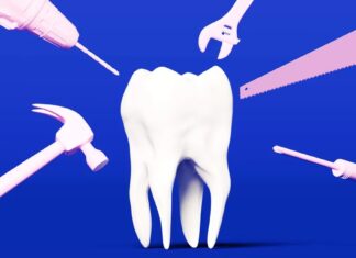 Чіпси з сиром та карієс: прихований ризик для зубів